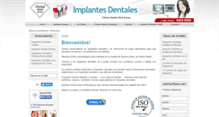 Desktop Screenshot of dentales-implantes.com.ar