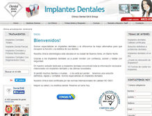 Tablet Screenshot of dentales-implantes.com.ar